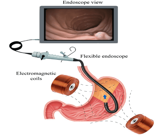 Endoscopes